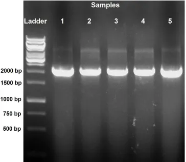 Figure 6: PCR analysis confirming the synthesis of pDRYFP.  A PCR was run to confirm the construction of pDRYFP in five samples