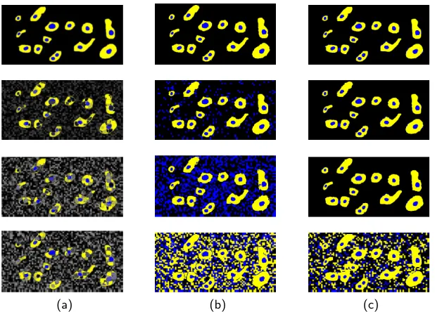 Fig. 4. Dice accuracies of segmentation for the proposed method and Gaussian Mixturesegmentation accuracy