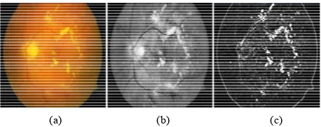 Figure 1. Result of preprocessing methods. (a) Original image; (b) Filtered image; (c) Enhanced image