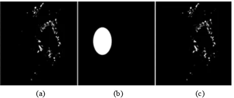 Figure 2. Result of exudates detected methods. (a) Candidates; (b) OD localized; (c) Exudates