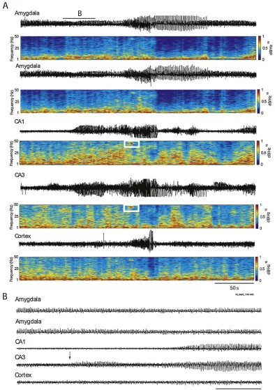 Figure 1.5: (A) EEG depth recordings in rat depicting a seizure recorded simultaneously in the amygdala, hippocam-pus and neocortex ~2 h following intra-peritoneal (systemic) administration of KA (6 mg/kg)
