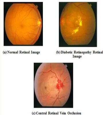 Figure 1:  Retinal Images 