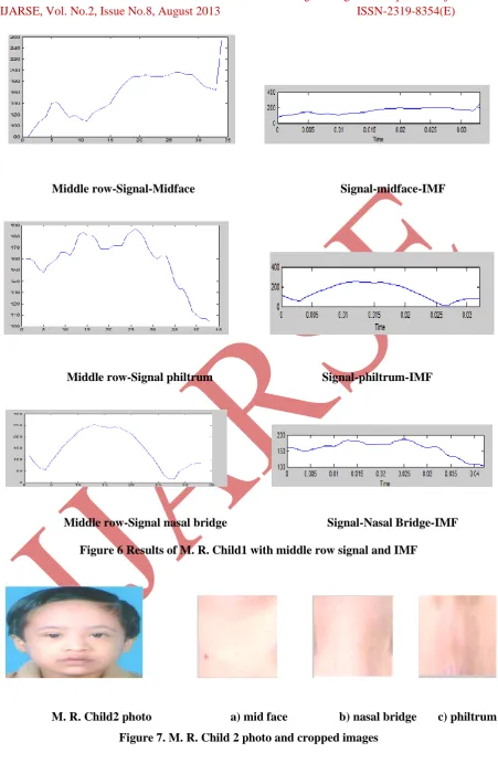 Figure 6 Results of M. R. Child1 with middle row signal and IMF 