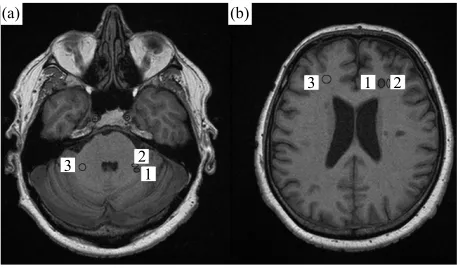Figure 1Whenever possible, lesions with a corresponding lesion- 