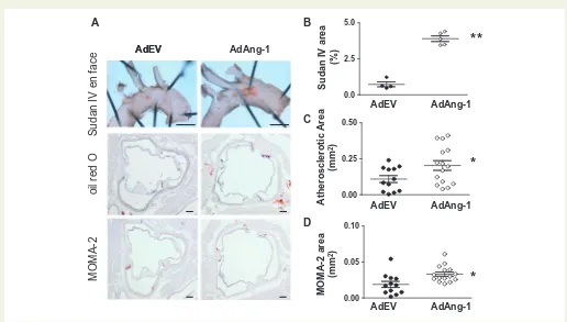 Figure 2 Ang-1 promotes early atherosclerotic plaque formation in ApoEfrom each animal were analysed for MOMA-2-positive lesion size (mminfected systemically with adenoviruses encoding Ang-1 (AdAng-1), or control virus (AdEV)