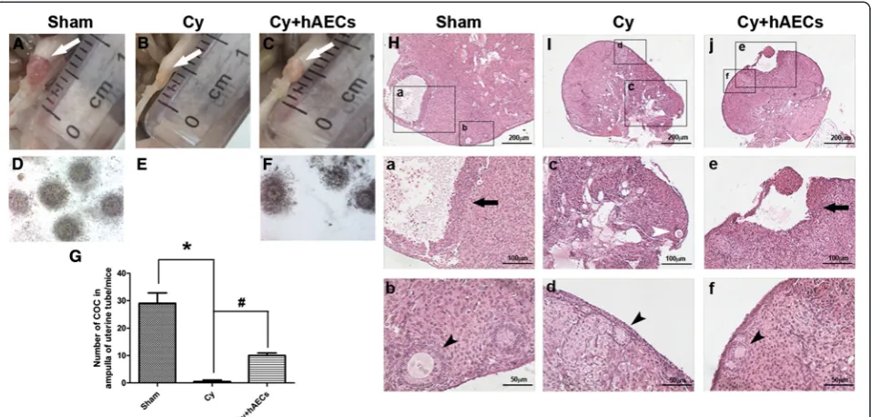 Fig. 5 hAEC transplantation increased the number of cumulus oocyte complexes (COC) in chemoablated mice.group (n = 4),observed under microscopy.mean ± SEM; * A–C Images of ovarianmorphology followed superovulation in different groups 1 month after hAEC tra