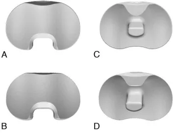 Figure 3.2: 3D geometry of the CR inserts from the CAD model (A) and micro-CT scan (B), and of the PS inserts from the CAD model (C) and micro-CT scan (D)