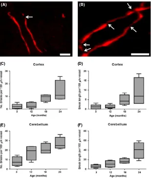 Figure 2. Age-associated loss of ZO-1 in mice. (breaks were also detected in the cerebellum