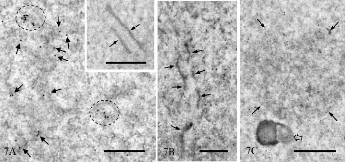 Figure 6. Immunogold staining for TRA98 after silver enhancement. (A) The nucleus of pachytene spermatocyte at stage VI