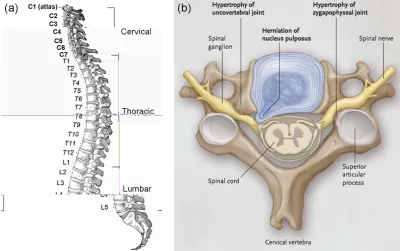 Figure 2.1vertebrae in the cervical, thoracic and lumbar regions with the exception of C1 and C2