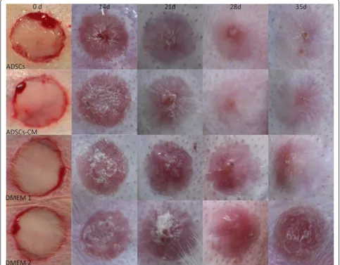 Fig. 3 Gross examination images. Both ADSC- and ADSCs-CM-treated scars improved significantly on gross examination and were softer and lessvisible compared with their internal controls (DMEM 1 and DMEM 2), which gradually became raised, red, and stiff afte