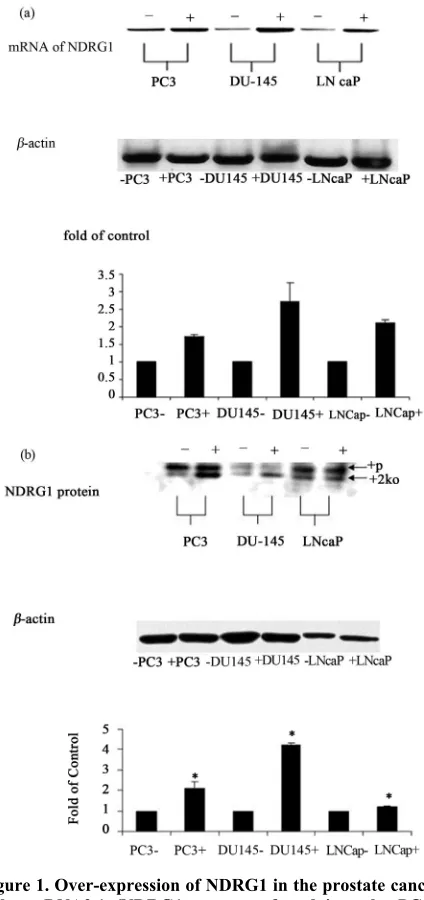 Figure 1. Over-expression of NDRG1 in the prostate cancer cells. pcDNA3.1+/NDRG1 was transfected into the PC-3, DU145 and LNCaP cells and mRNA expression levels of the gene were detected by RT-PCR (a) and protein levels by western blotting (b)