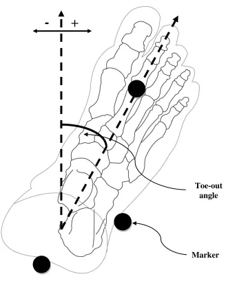 Figure 1.4. An illustration of toe-out angle measured as a line connecting the middle of 