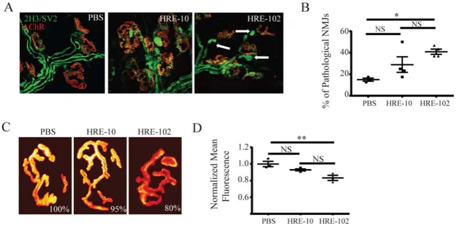 Figure 3. Neuromuscular junction (NMJ) defects are present in the HRE-102 mice. (A-B) 