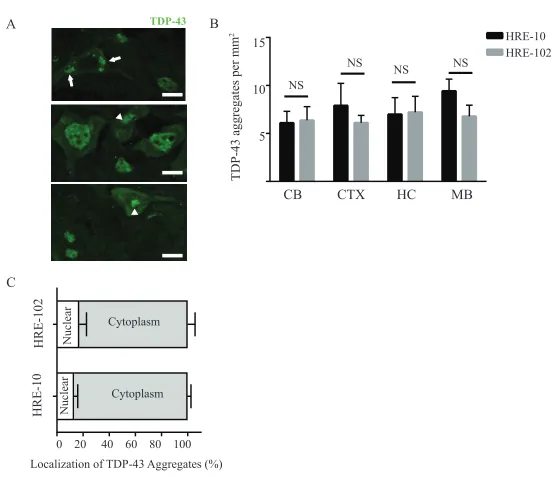 Figure S3. No differences in presence of TDP-43 aggregates between HRE-10 and HRE-102 mice
