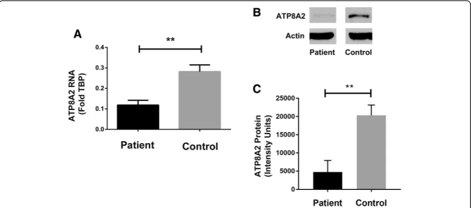 Fig. 2 ATP8A2 expression in gut endoderm cells differentiated from patient and control fibroblasts