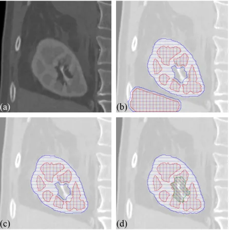 Figure 3.8: Kidney segmentation (a) is very difﬁcult to automate due to low contrast and complex topol-ogy