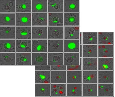 Figure 2. Concentration-dependent increase in the per- centage of dying CETC during incubation with different concentrations in a patient with cells sensitive to and a pa- tient with cells resistant to the drug doxorubicin