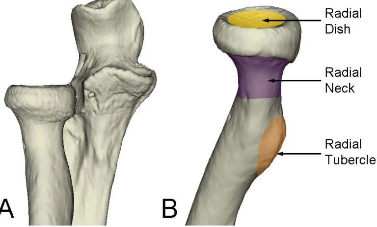 Figure 1.4: Osteology of the Proximal Radius  