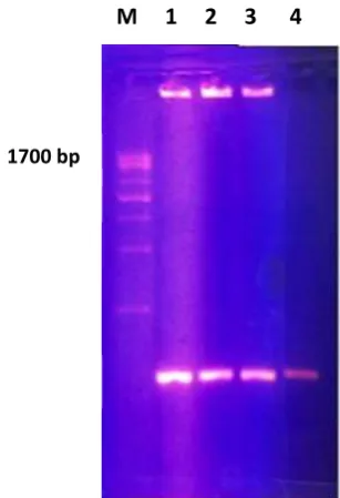 Table 1: Brucella abortus sequences that produce higest significant alignments with   the BCSP-31 