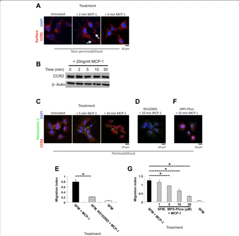 Fig. 3 CCR2 and GPCRmarrow-derived stromal cell,MCP-1GPCRexperiments. Data are presented as mean ± SD