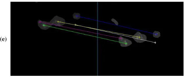 Figure 8.  Double-view image processing for in-situ captured images: (a) preprocessed images; (b) result after 