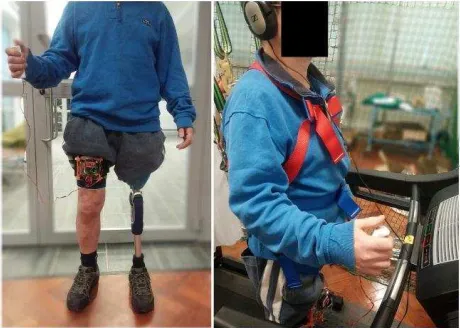 Figure 3.  Haptic device fitted on the amputee participant, in standing mode (left) and on the treadmill (right)