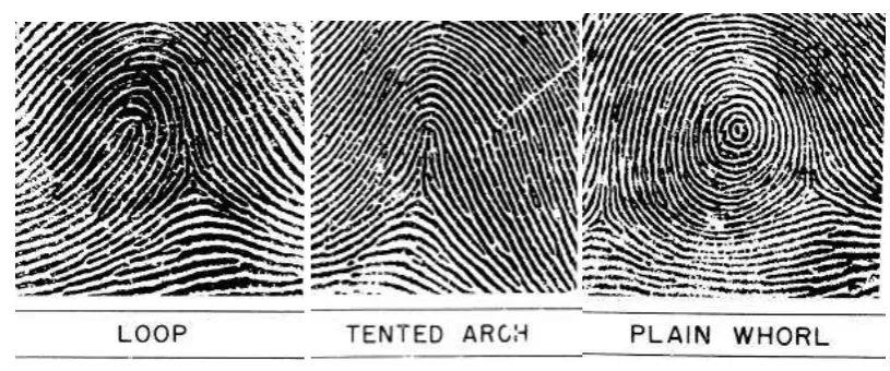 Fig 4 Fingerprint Patterns 