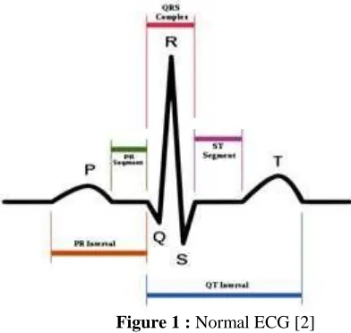 Figure 1 : Normal ECG [2] 