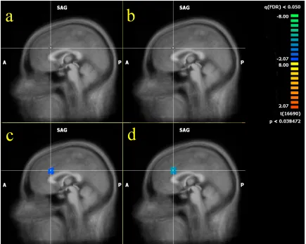 Figure 3.3: fMRI images.  