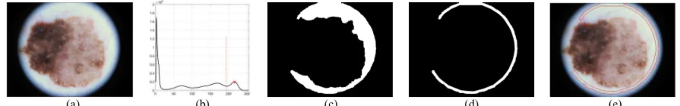 Fig. 4.  Procedure of circle detection for construction of the circle probability  map:  image  (a)  is  the  original  input  to  the  algorithm,  (b)  is  the  centerMap showing  high  values  near  the  circle’s  center  location,  and  (c)  is  obtaine