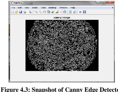 Figure 4.2: Snapshot of Image Enhancement Processing 