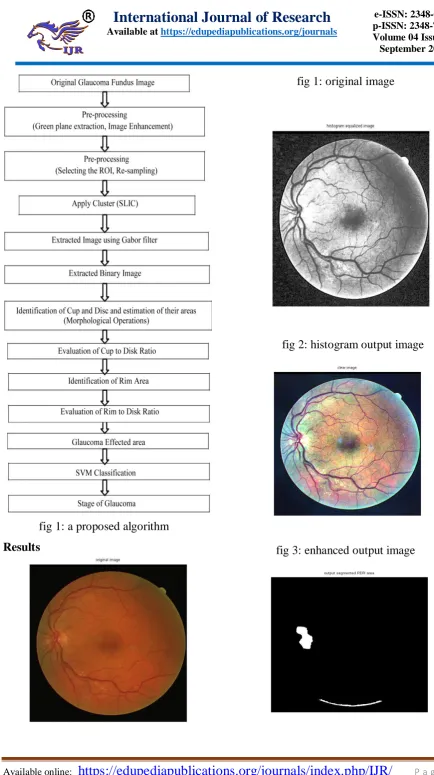 fig 1: a proposed algorithm  