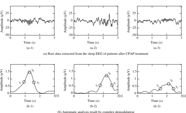 Figure 2. Sleep EEG data analysis by complex demodulation for sleep spindle detection.