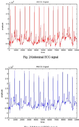 Fig. 3 Maternal ECG signal 