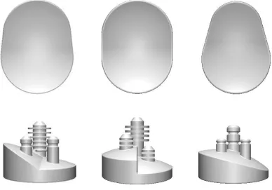 Figure 1.9: Three commercially available augmented glenoid component designs  
