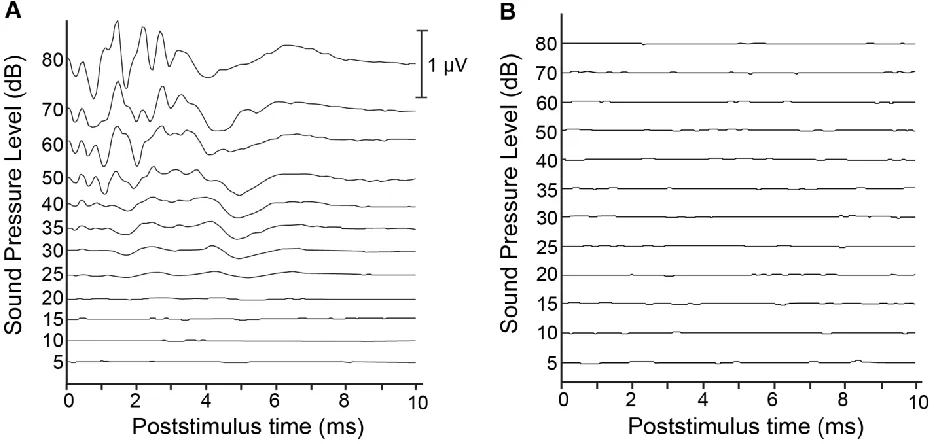 Figure 2.3  Pre- and post-deafening auditory brainstem responses. 