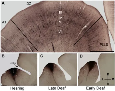 Figure 2.2.4  Cortical border delimitation. 