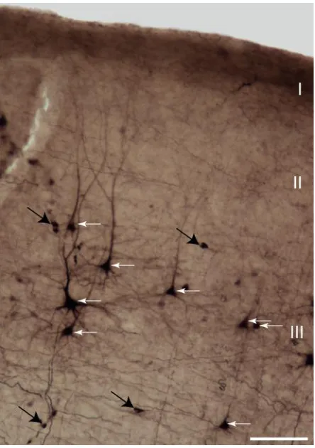 Figure 2.5  BDA-labeled neurons in A1. 