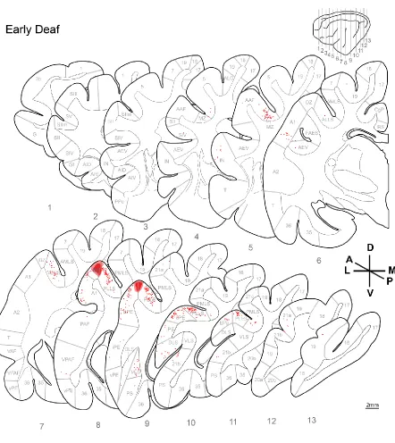 Figure 2.11  Injection sites and labeled neurons on std. sections. 
