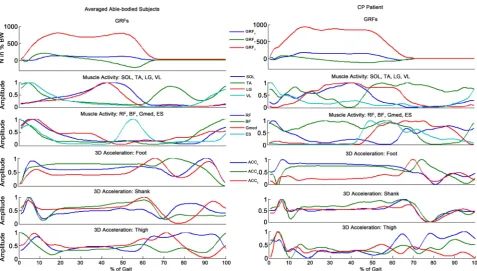 Figure 6. Multiple Sensory Data Fusion for Diagnosis of a Patient with Diplegia Cerebral Palsy (3D accelerations in foot, shank and thigh color indications: blue = saggital; green = frontal; red = transverse)