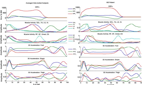 Figure 7. Multiple Sensory Data Fusion for Diagnosis of a Patient with Multiple Sclerosis (3D accelerations in foot, shank and thigh color indications: blue = saggital; green = frontal; red = transverse)
