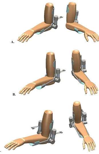 Fig. 2.5. Mechanical design of an elbow wearable powered brace. 