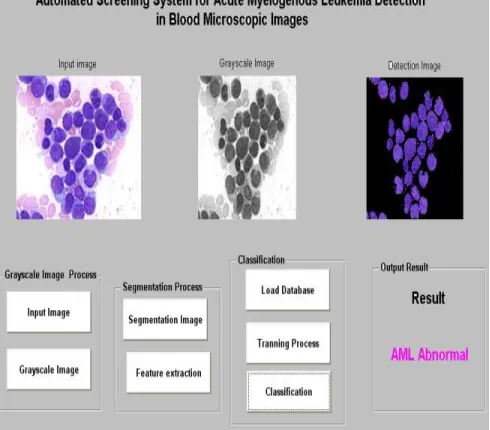 Figure 6: AML Classification of Existing Method 