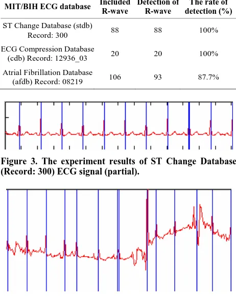 Figure 4. The experiment results of Atrial Fibrillation Da-tabase (Record: 08219) ECG signal (partial)