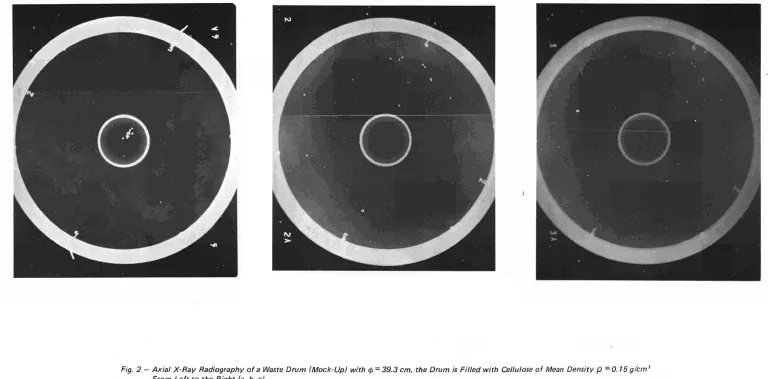 Fig. 2 - Axial X-Ray Radiography 