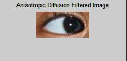 Figure 3: Image preprocessing using Adaptive Anisotropic Diffusion Filter   