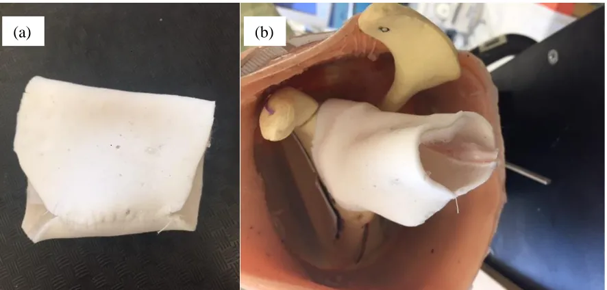 Figure 3.10: (a) Straw mould and biceps tendon. (b) Biceps tendon attached to glenoid