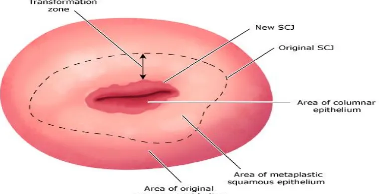 Fig 2. Transformation zone of cervix 