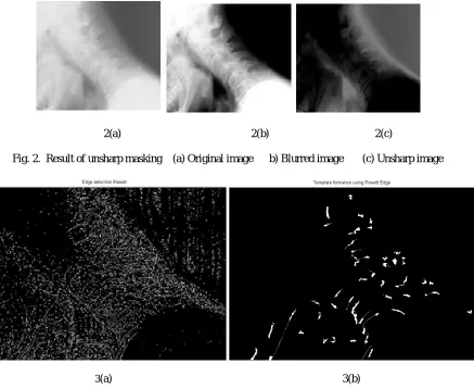 Fig. 2.  Result of unsharp masking    (a) Original image      b) Blurred image       (c) Unsharp image 